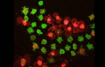 Ecco il 'bottone rosso' per l'autodistruzione delle cellule tumorali. E' una combinazione di farmaci