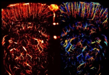 Il primo sguardo dentro un organo vivo. Grazie alla supervista a ultrasuoni